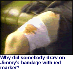 Jimmy's Wound