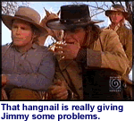 Hangnail